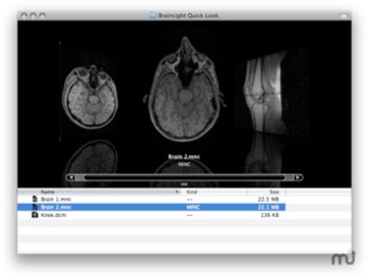 Image 0 for Brainsight Quick Look