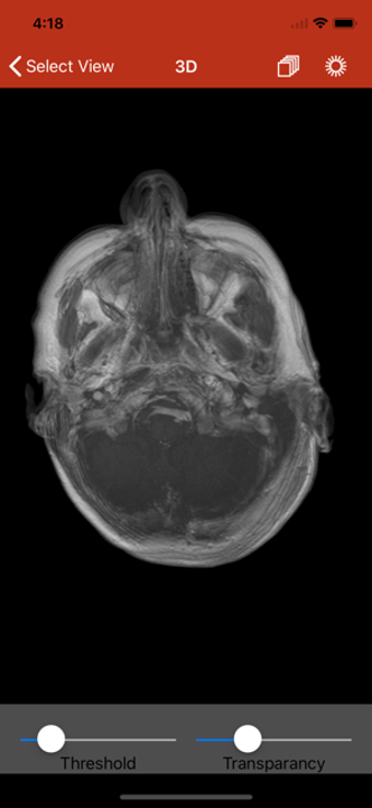 Image 0 for Med View