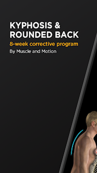 Image 3 for Kyphosis & Rounded Back b…