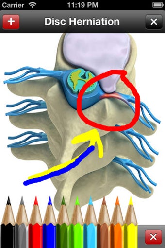 Image 0 for Med Sketch
