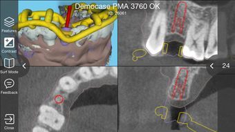 Image 2 for smop