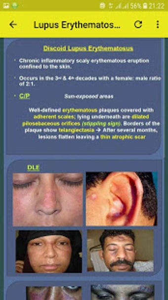 Imagen 3 para Color Atlas of Skin Disea…