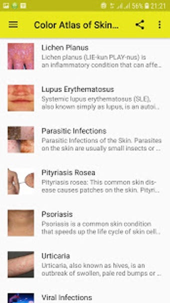 Imagen 1 para Color Atlas of Skin Disea…