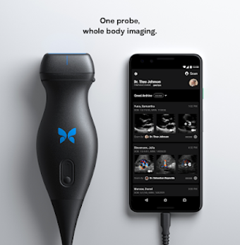 Imagen 0 para Butterfly iQ  Ultrasound