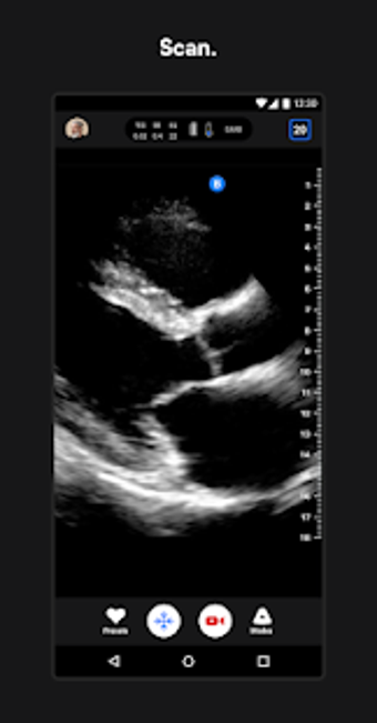 Imagen 2 para Butterfly iQ  Ultrasound
