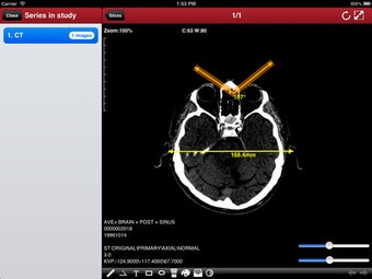 Image 0 for DicomBox Free