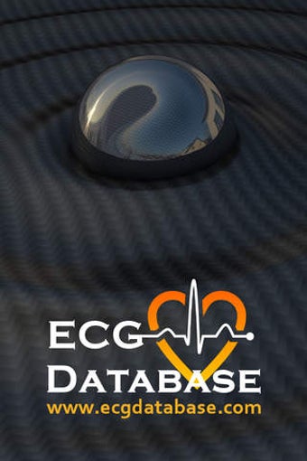 Image 0 for ECG Database