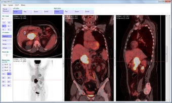 Imagen 0 para Radis PET-CT