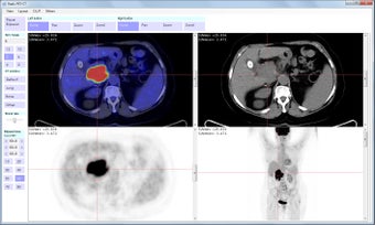 Imagen 1 para Radis PET-CT
