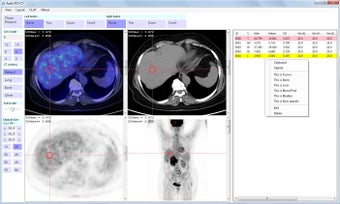 Imagen 1 para Radis PET-CT