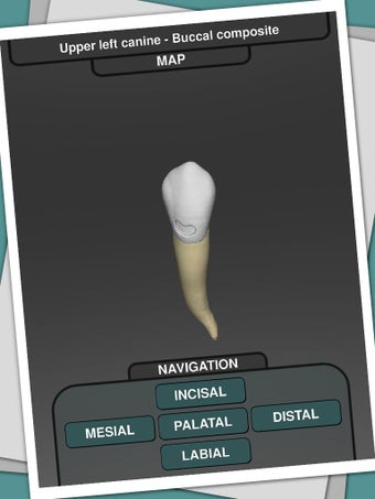 Imagen 2 para CavSim : Dental Cavity Tr…