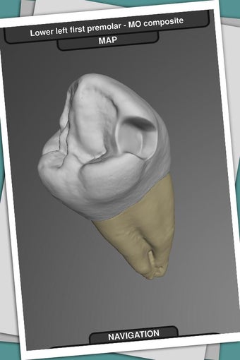 Image 0 for CavSim : Dental Cavity Tr…