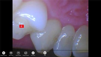 Imagen 1 para MouthWatch ExamTab for Wi…