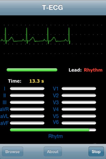 Image 1 for T-ECG User Telephonic ECG