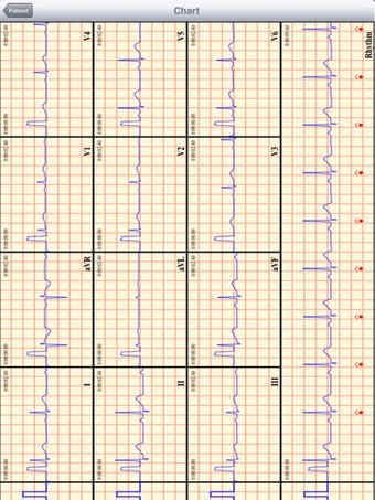 Image 2 for T-ECG User Telephonic ECG