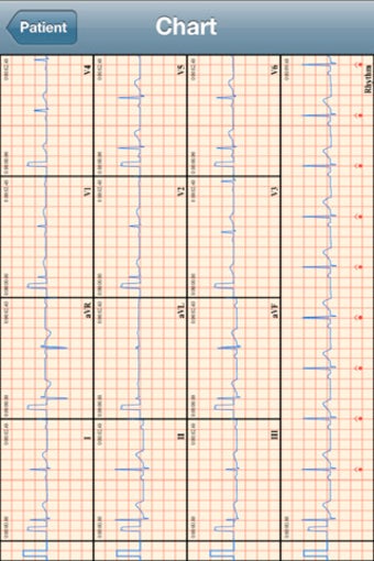 Image 3 for T-ECG User Telephonic ECG
