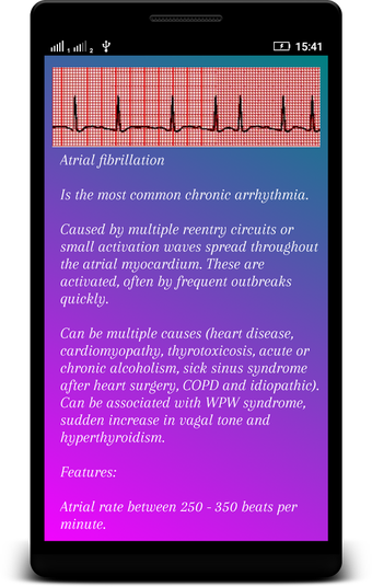Imagen 0 para ECG Interpretation