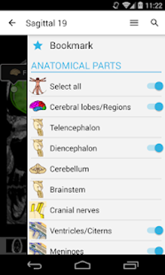 Imagen 3 para e-Anatomy