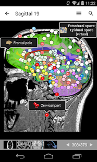 Imagen 0 para e-Anatomy