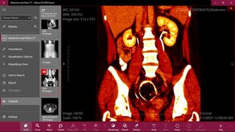 Imagen 3 para Athena DICOM Viewer for W…