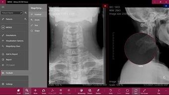 Imagen 0 para Athena DICOM Viewer for W…