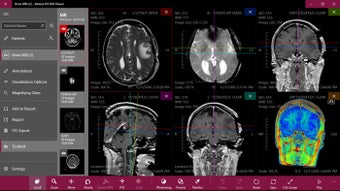 Imagen 2 para Athena DICOM Viewer for W…
