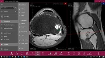 Imagen 1 para Athena DICOM Viewer for W…