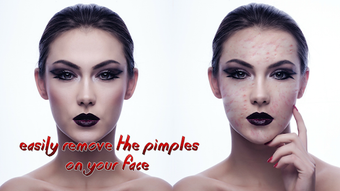 Image 2 for Pimples removing photo ed…