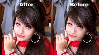 Image 0 for Pimples removing photo ed…