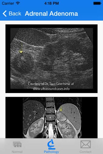 Image 0 for Ultrasound +