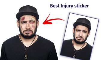 Imagen 0 para Fight Injury Face Photo E…