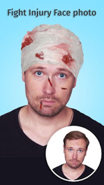 Imagen 1 para Fight Injury Face Photo E…