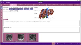 Image 1 for SonoWrite for Windows 10