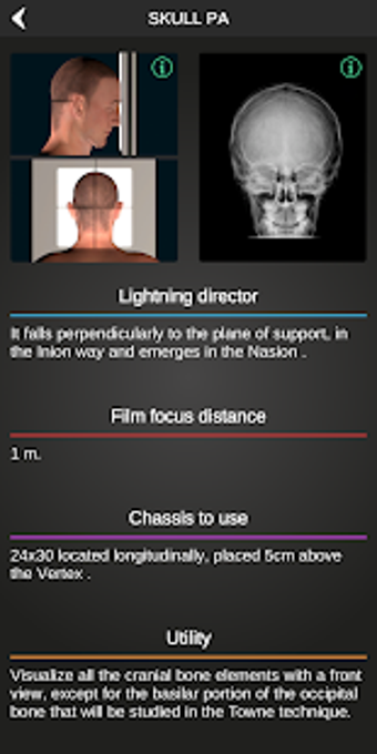 Imagen 2 para RX - Radiographic Positio…