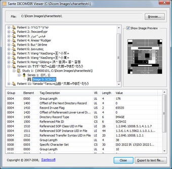 Image 0 for Sante DICOMDIR Viewer