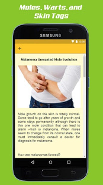 Image 1 for Mole Removal Remedies