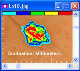 Image 0 for MoleSense