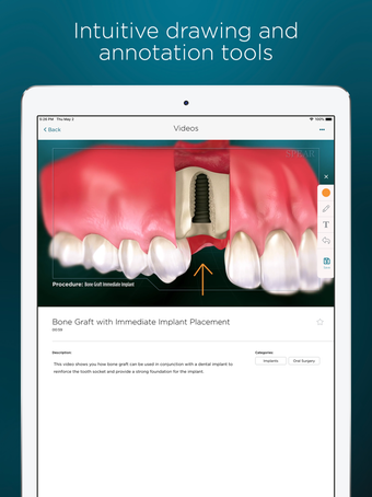 Image 3 for Spear Patient Education
