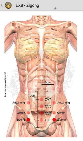 Imagen 2 para Acupuncture Assistant