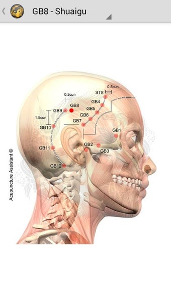 Image 1 for Acupuncture Assistant