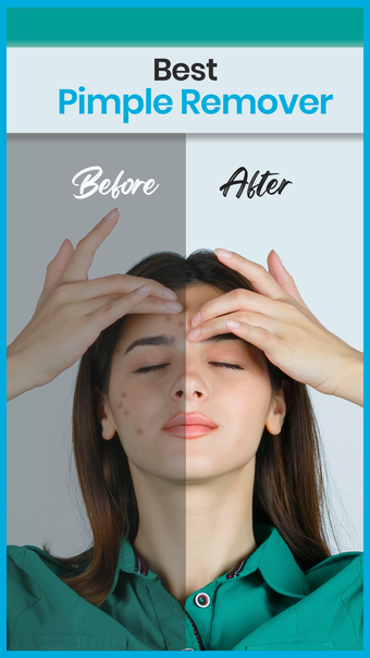 Image 0 for Beauty Face - Pimple Eras…