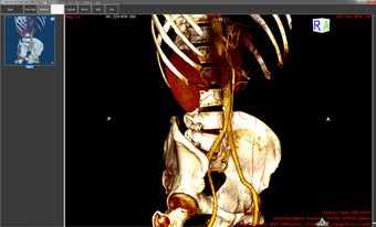 Imagen 0 para ORPALIS DICOM Viewer Free…