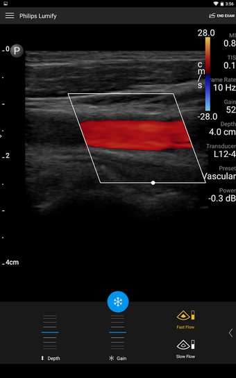 Image 0 for Philips Lumify Ultrasound…