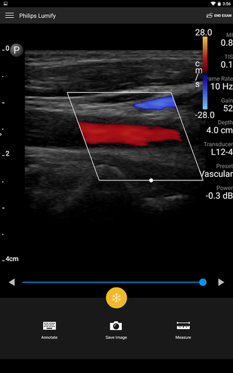 Image 2 for Philips Lumify Ultrasound…