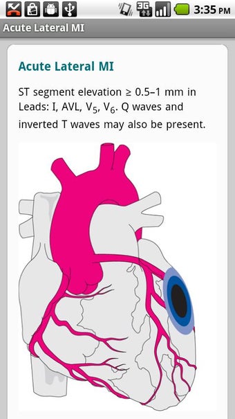 Imagen 2 para Critical Care ACLS Guide