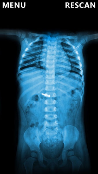 Imagen 2 para X-Ray Scanner Body Prank