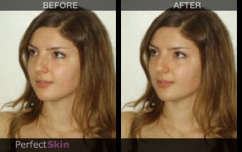 Image 1 for Perfect Skin