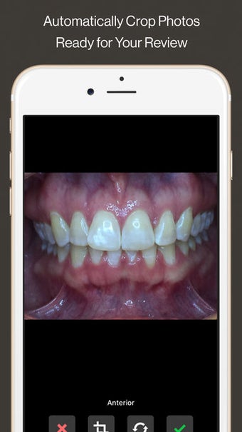 Image 3 for Invisalign Photo Uploader