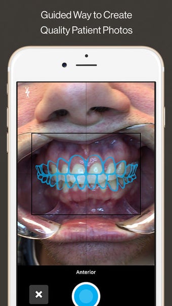 Image 1 for Invisalign Photo Uploader