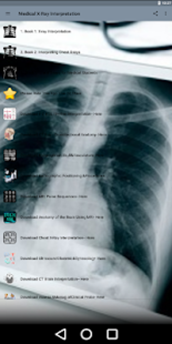 Image 0 for X-Ray -Medical XRay Inter…